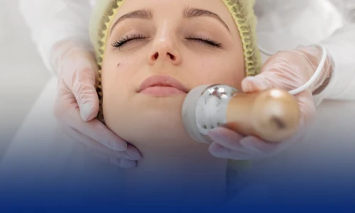 Bioestimulador de Colageno